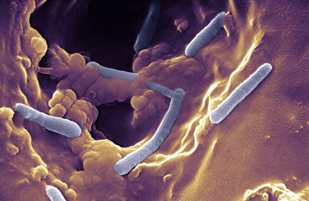 HSE managing outbreak of potentially serious infection at Limerick neonatal intensive care unit