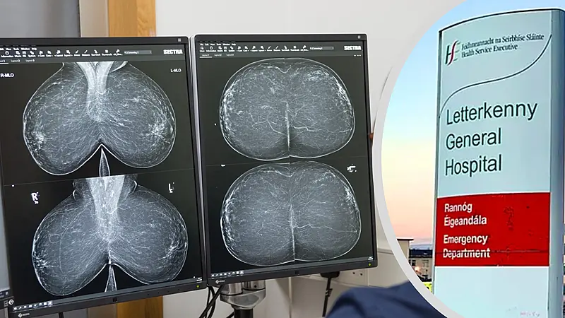 Nearly 90% of urgent breast referrals at Letterkenny Hospital miss target