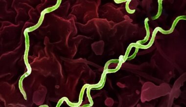 Chile reports historic high in syphilis cases in 2025