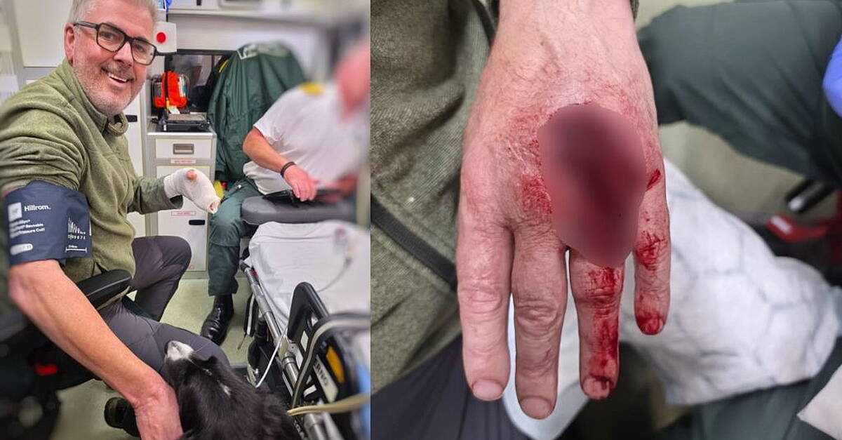 Photographer James O'Donnell opens up about near-death "freak accident" fire