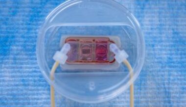 'Metastasis-on-a-chip' to advance understanding of cancer spread • healthcare-in-europe.com