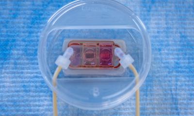 'Metastasis-on-a-chip' to advance understanding of cancer spread • healthcare-in-europe.com