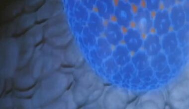 RTÉ Archives | Health | Vaccine To Prevent Cancer
