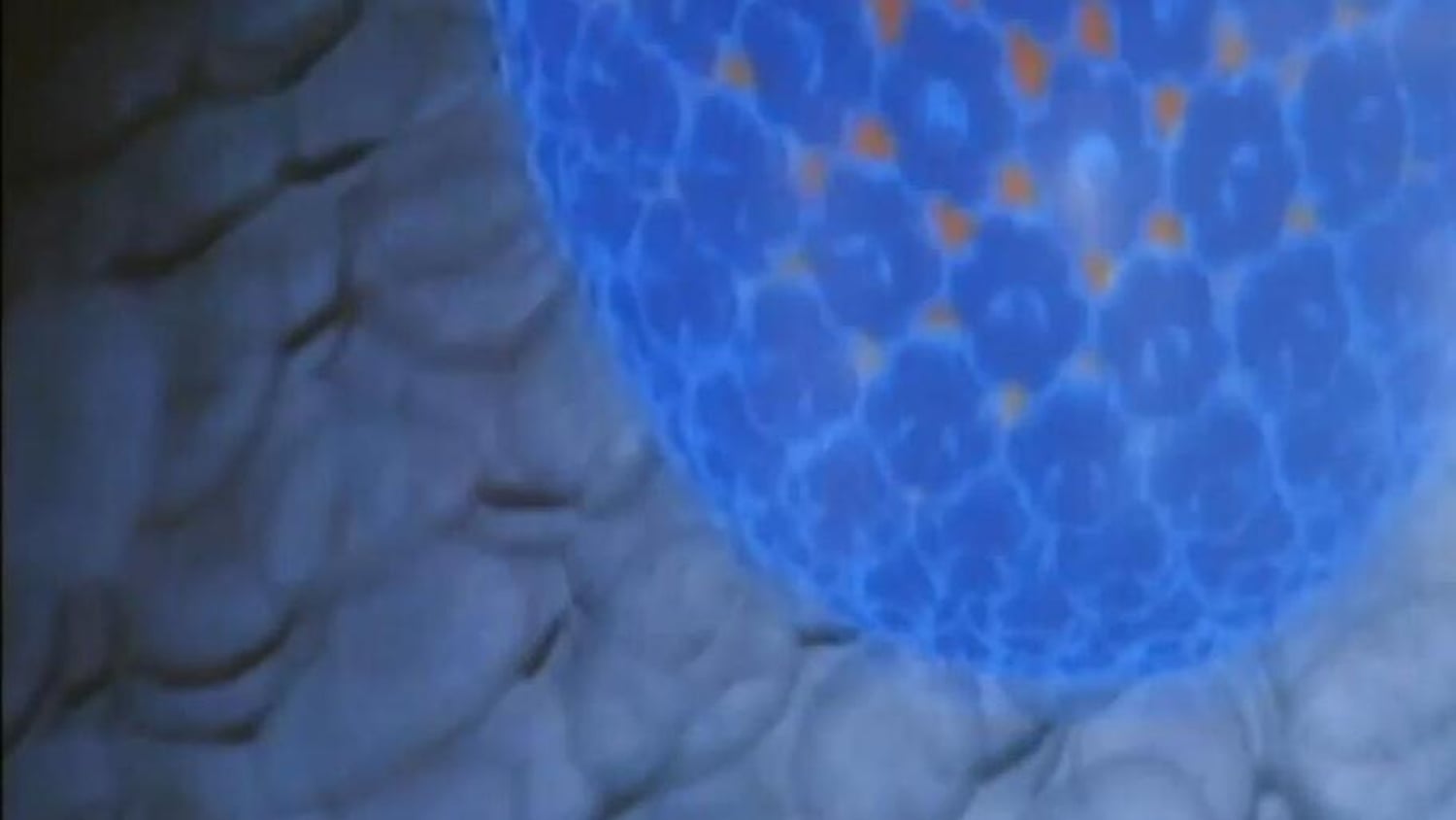 RTÉ Archives | Health | Vaccine To Prevent Cancer