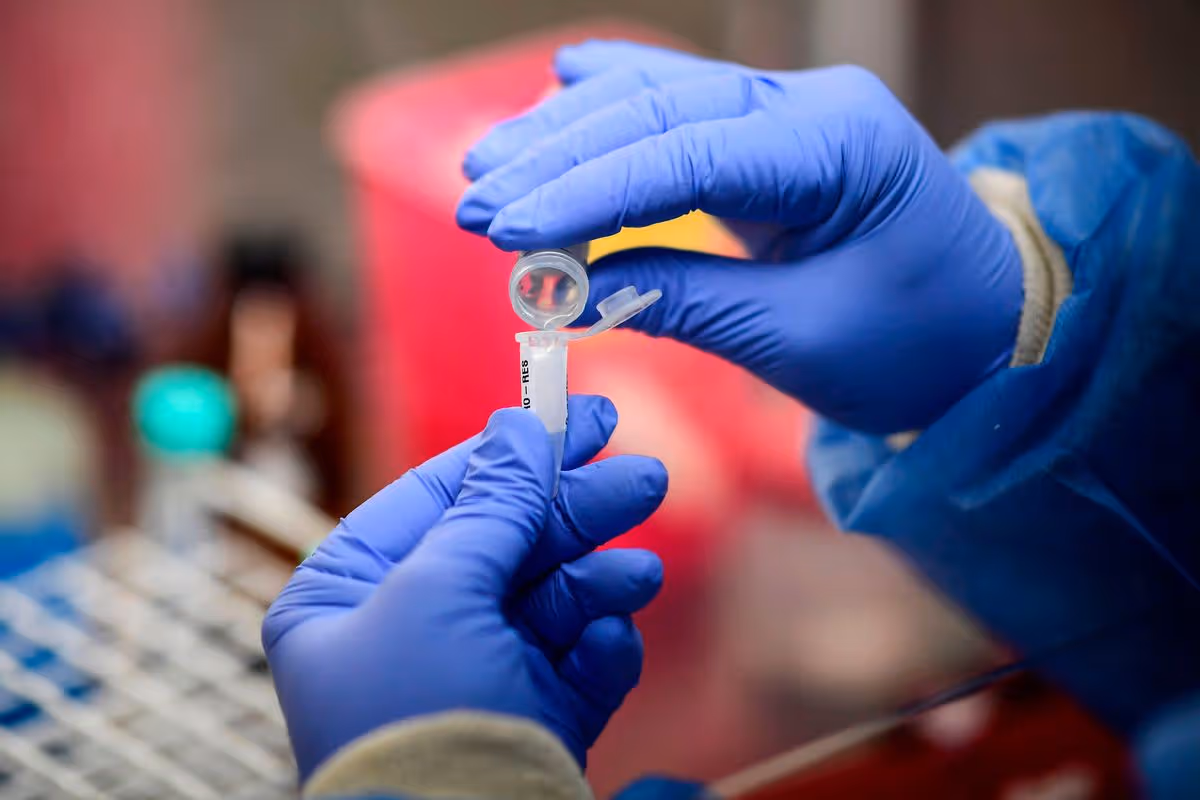 A doctor handles a COVID-19 test at the Professor Alejandro Posadas National Hospital in the municipality of El Palomar, province of Buenos Aires, on September 18, 2020, amid the novel coronavirus pandemic.