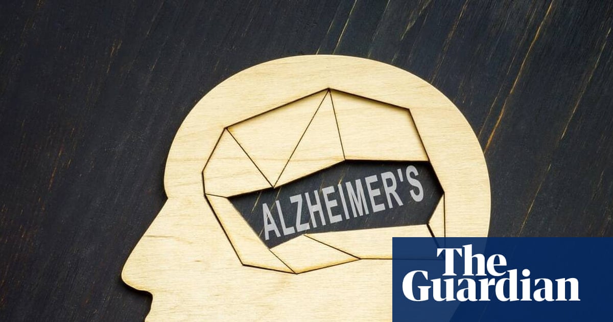 Alzheimer’s trial to test drug on people without symptoms to see if it can be prevented | Alzheimer's