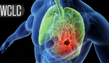 Local Consolidative Therapy After Dual Immunotherapy Fizzles in Metastatic NSCLC