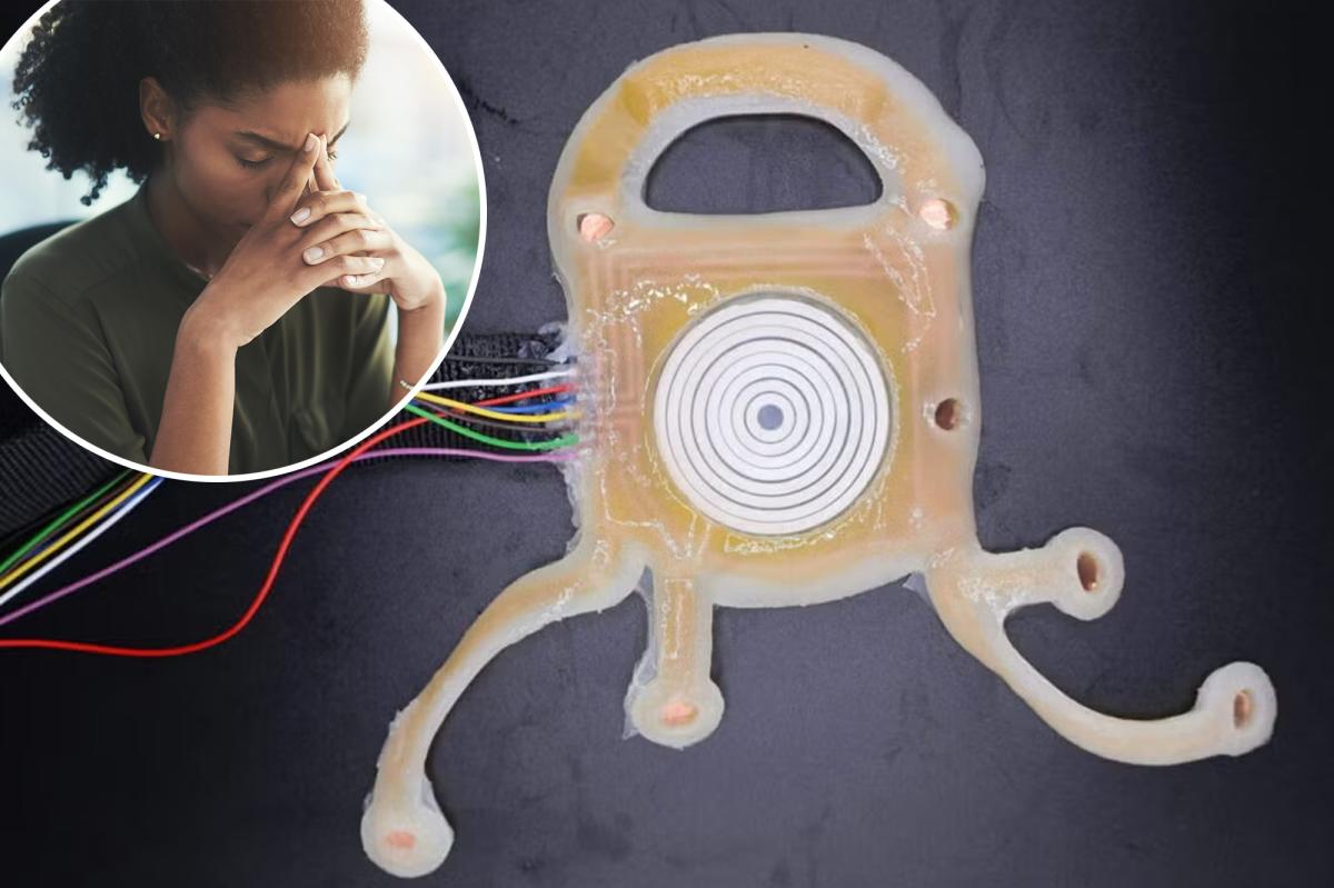 Skin patch worn while you sleep could manage stress during the day