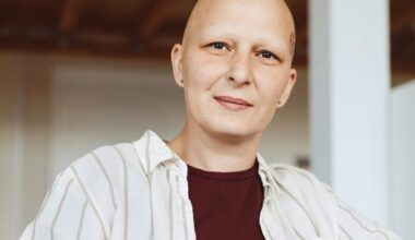 Arthritis Drug Demonstrates Substantial Hair Regrowth in 1,400 Alopecia Patients