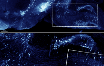Bruker advances whole-organism 3D imaging with enhanced tissue-clearing workflows