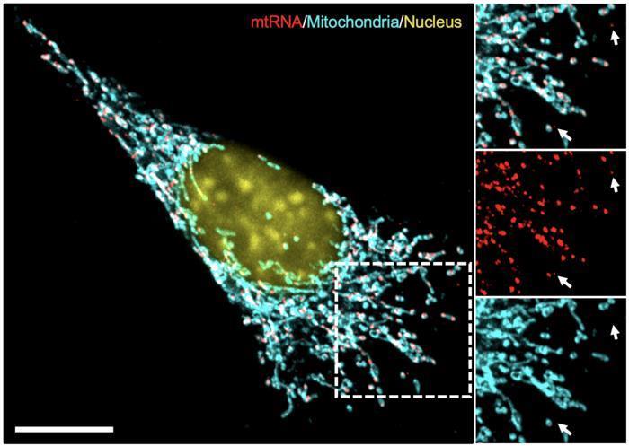 Interferons, mitochondrial dysfunction and PGE2: Salk study reveals mechanism behind immunotherapy resistance