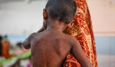 Suspected measles cases kill nearly 1,000 as Bangladesh struggles to contain outbreak