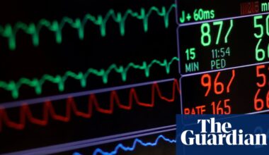 Adults with severe mental illness die 15 to 20 years earlier from diseases such as cancer | Mental health
