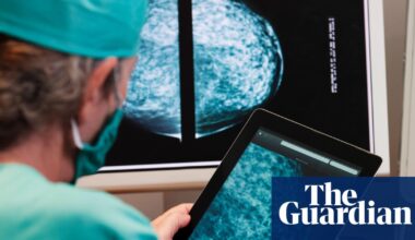 AI will help find cure for cancer ‘within our lifetimes’, says Arm Holdings chief | Arm
