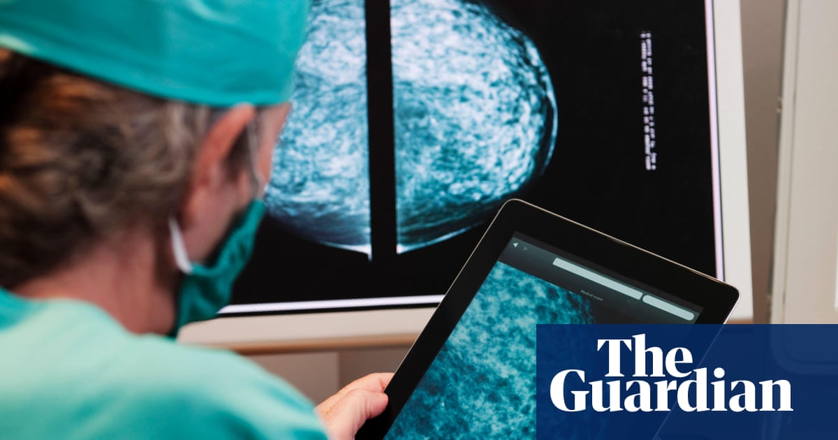 AI will help find cure for cancer ‘within our lifetimes’, says Arm Holdings chief | Arm