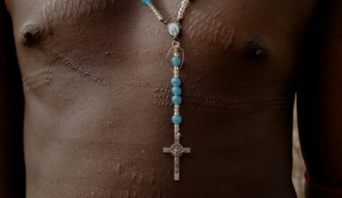 The scarred chest of a Samburu warrior wears a silver and blue rosary.