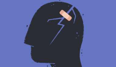 Updated migraine prevention guidelines reflect new drug options