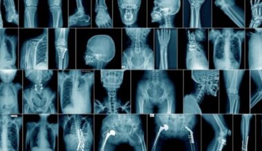 Radiologists concerned over patient scans reviewed by unregistered doctors abroad – The Irish Times