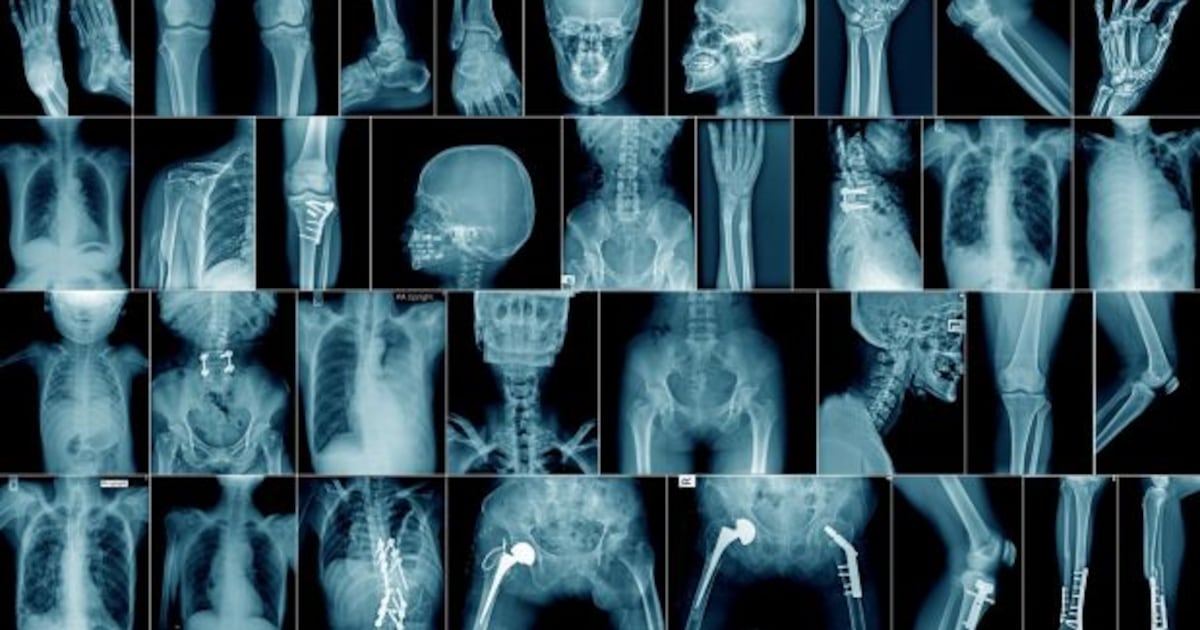Radiologists concerned over patient scans reviewed by unregistered doctors abroad – The Irish Times