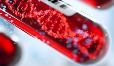 Could a liquid biopsy detect pancreatic cancer at its earliest stages?