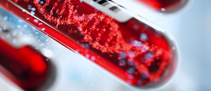 Could a liquid biopsy detect pancreatic cancer at its earliest stages?