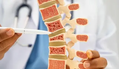 osteoporosis