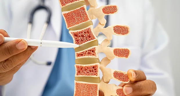 osteoporosis
