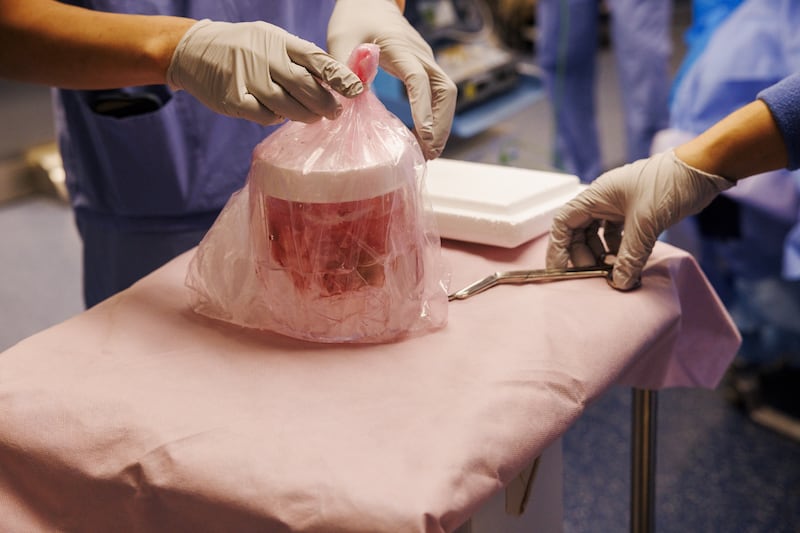 The genetically edited pig kidney allowed Mr Andrews to stay off dialysis for nine months in a world first