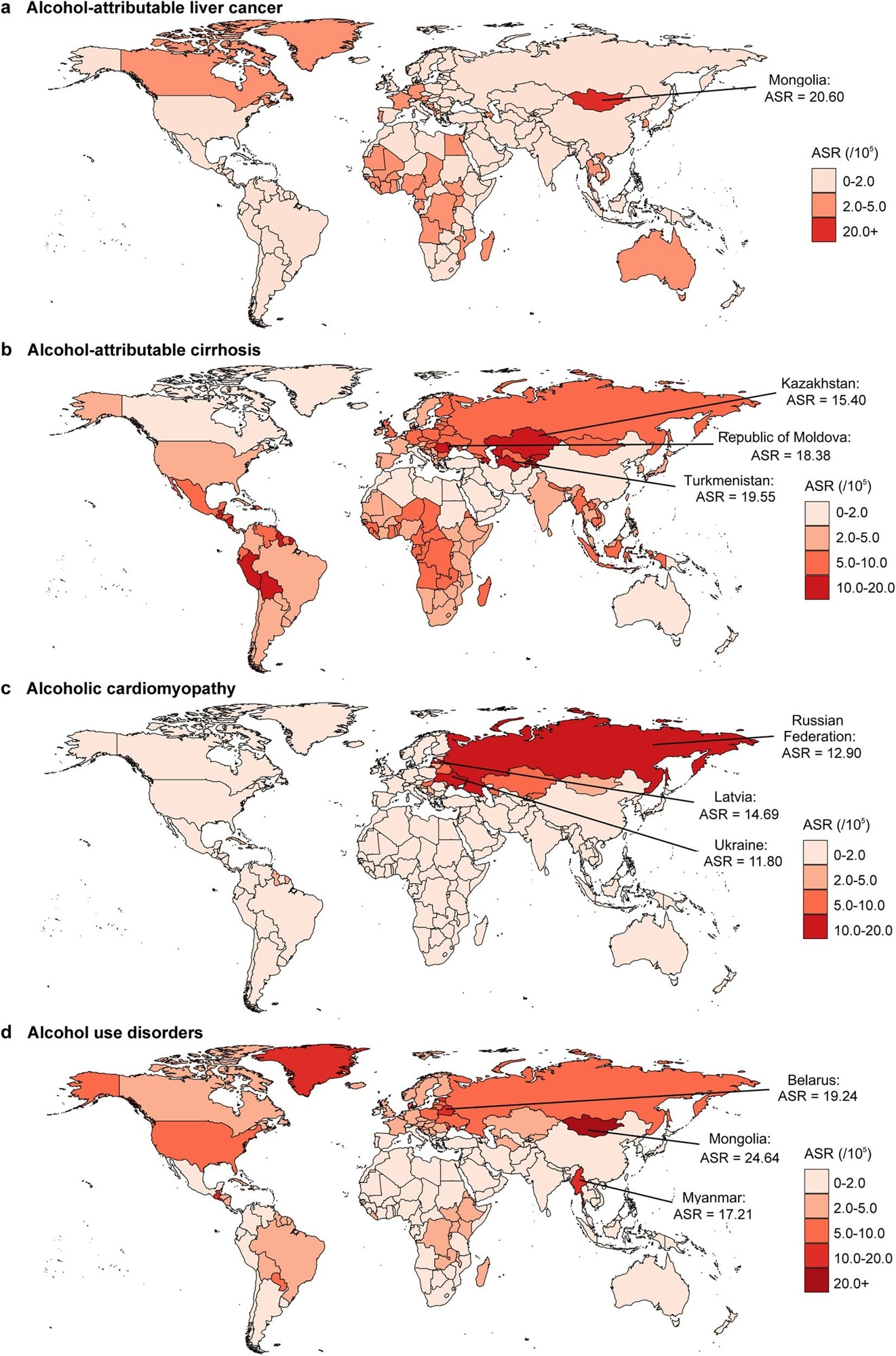 Age-standardized mortality rate of alcohol-attributable conditions in 2023 across different countries and territories. These conditions include alcohol-attributable liver cancer (a), alcohol-attributable cirrhosis (b), alcoholic cardiomyopathy (c), and alcohol use disorders (d). ASR = age-standardized mortality rate.