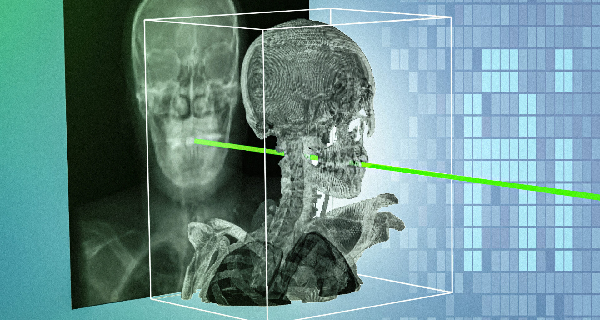 New AI technique could make minimally invasive surgeries safer and more precise | MIT News
