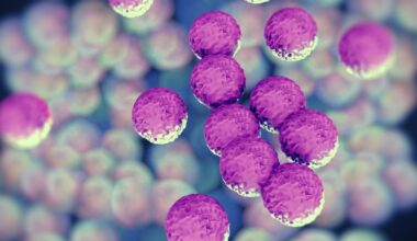 Bouncy castle play linked to largest outbreak of common superbug in Ireland – The Irish Times