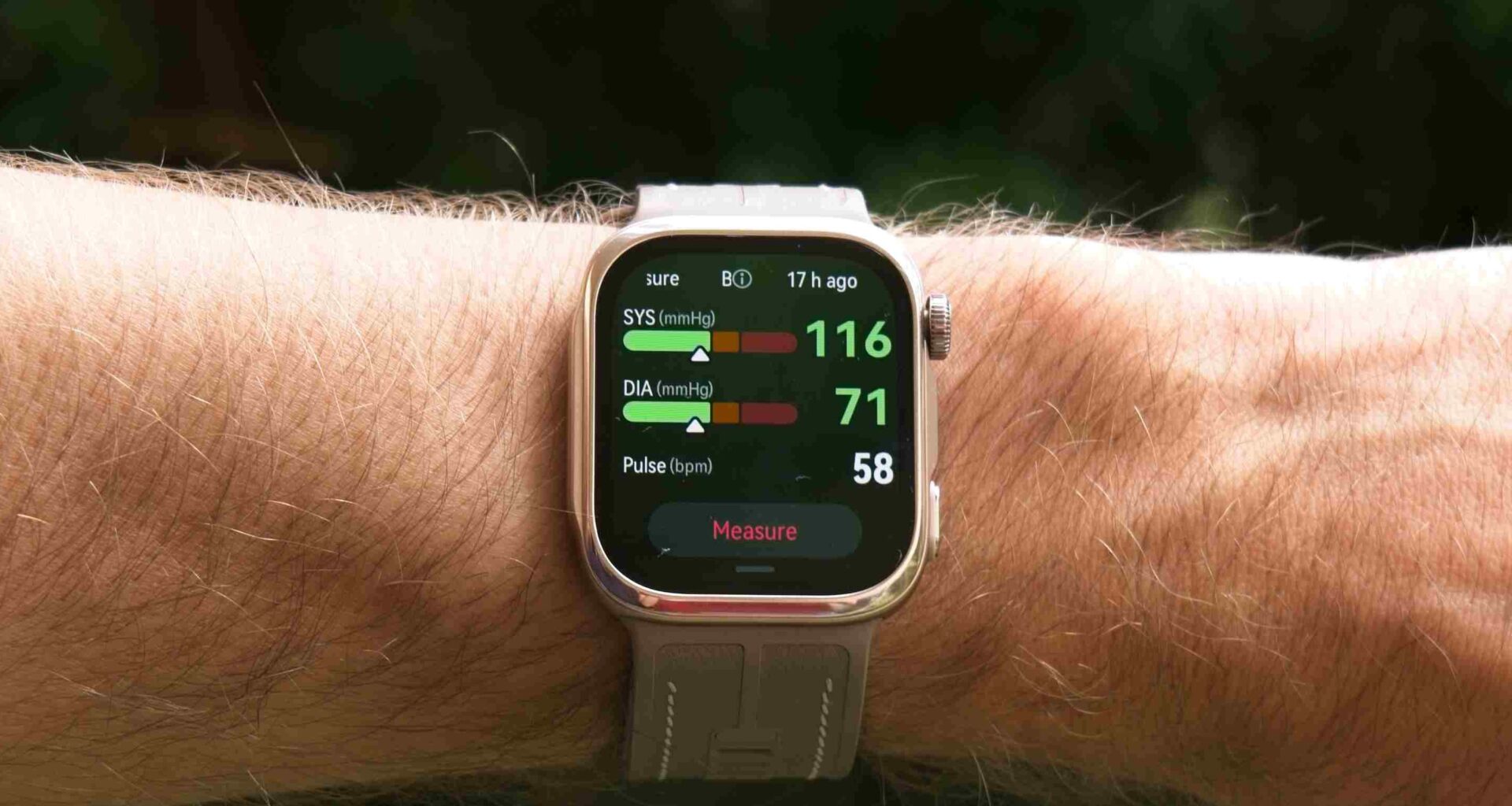 Huawei Watch D3 review: How the smartwatch measures arterial stiffness