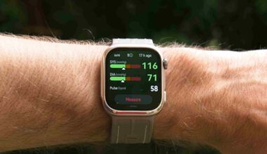 Huawei Watch D3 review: How the smartwatch measures arterial stiffness