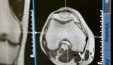 A Physikalisch-Technische Bundesanstalt project combining acoustics, MEG and fMRI found that humans can actually hear sounds below the assumed 16-hertz lower limit of audibility, and that the auditory cortex lights up in response to infrasound the ear was long thought to ignore entirely