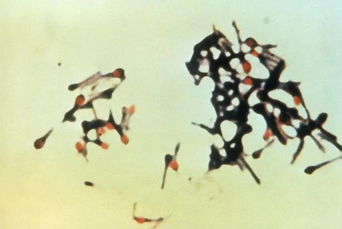Czech Republic: 1st tetanus case in 4 years reported in Northern Moravia