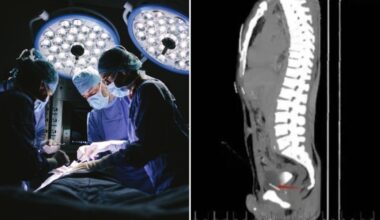 Doctors find 'foreign bodies' inside a man's chest, penis