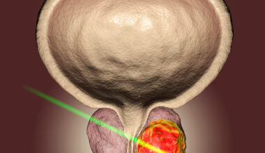 High-Risk Prostate Cancer GETUG-AFU 18 Suggests a Role for Dose-Escalated Radiotherapy With Long-Term ADT