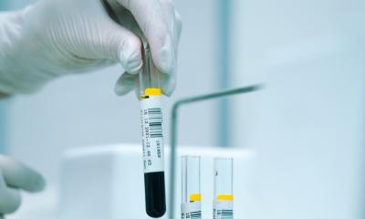 Blood test trends may help identify increased risk of cancer • healthcare-in-europe.com