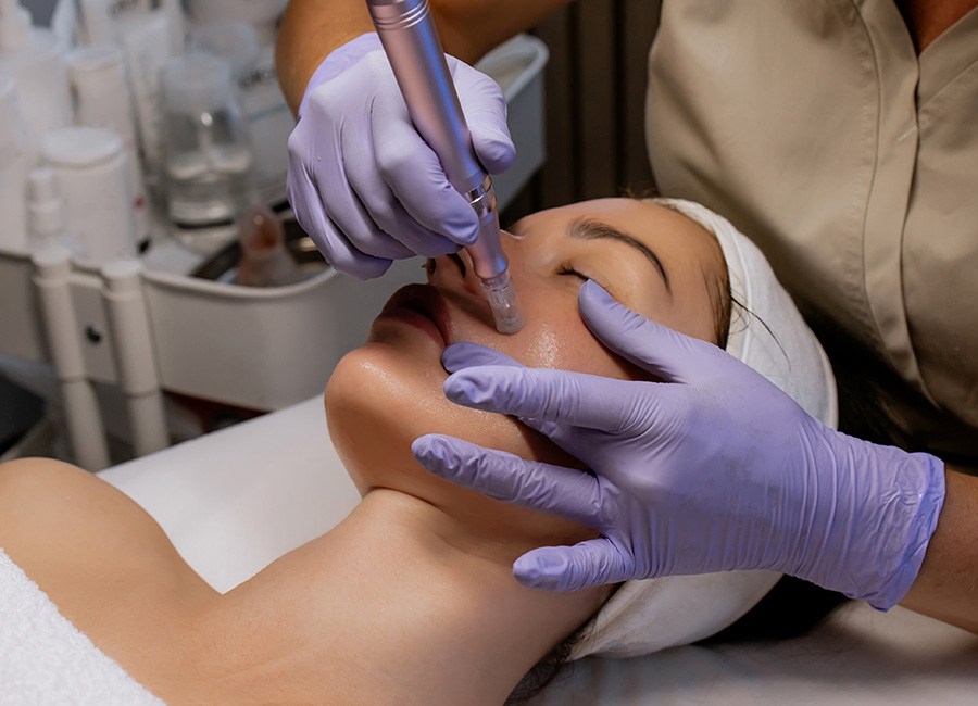 Microneedling Treatment Pic: Shutterstock