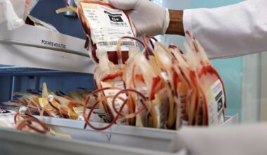 Scientists warn of weakening health systems and urge stronger outbreak detection