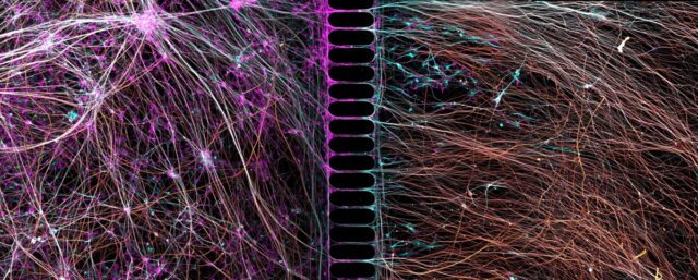 Human neurons reprogrammed from skin cells growing in a microfluidic chamber