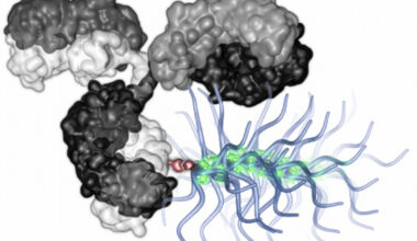 “Bottlebrush” particles deliver big chemotherapy payloads directly to cancer cells | MIT News
