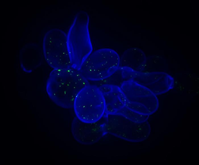 Yeast cells © Charité | Jakob Vowinckel