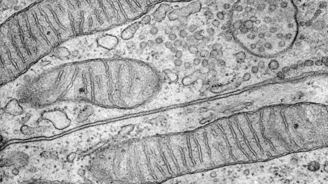 Long, narrow mitochondria with visible cristae shown under electron microscopy at 28000x magnification