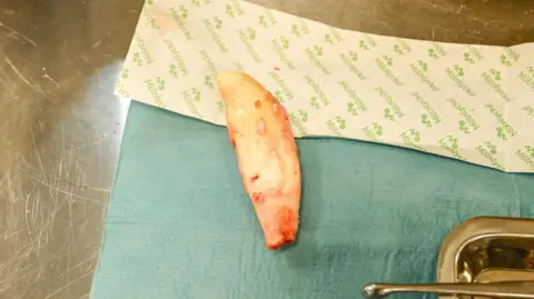 The Big Cat Sanctuary An extracted lion's lower canine which measures 8cm in length. It is placed on a surgery table.