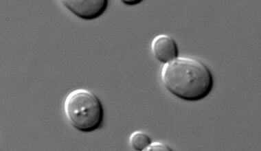 Saccharomyces cerevisiae, a species of yeast (Credit : Masur)