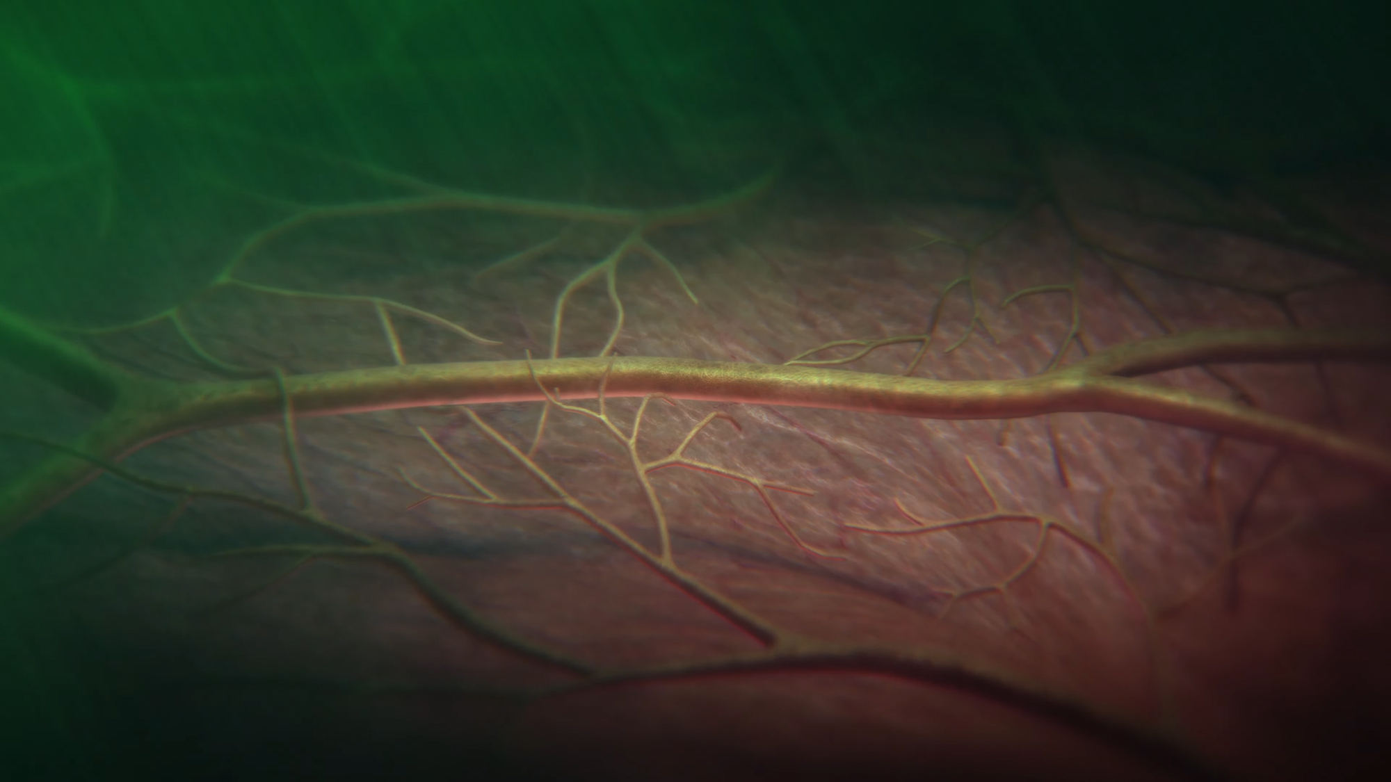 Apple Watch hypertension in the blood vessels