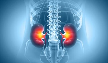 Diabetes Drug May Protect Against Kidney Inflammation