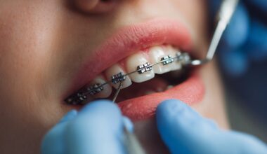 Orthodontic Industry