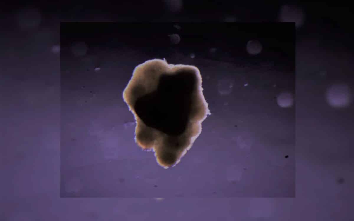 An Image Of Small Scale Muscle Tissue Made Using Bovine Cell Spheroids. (image Credit 3d Printing Solutions)